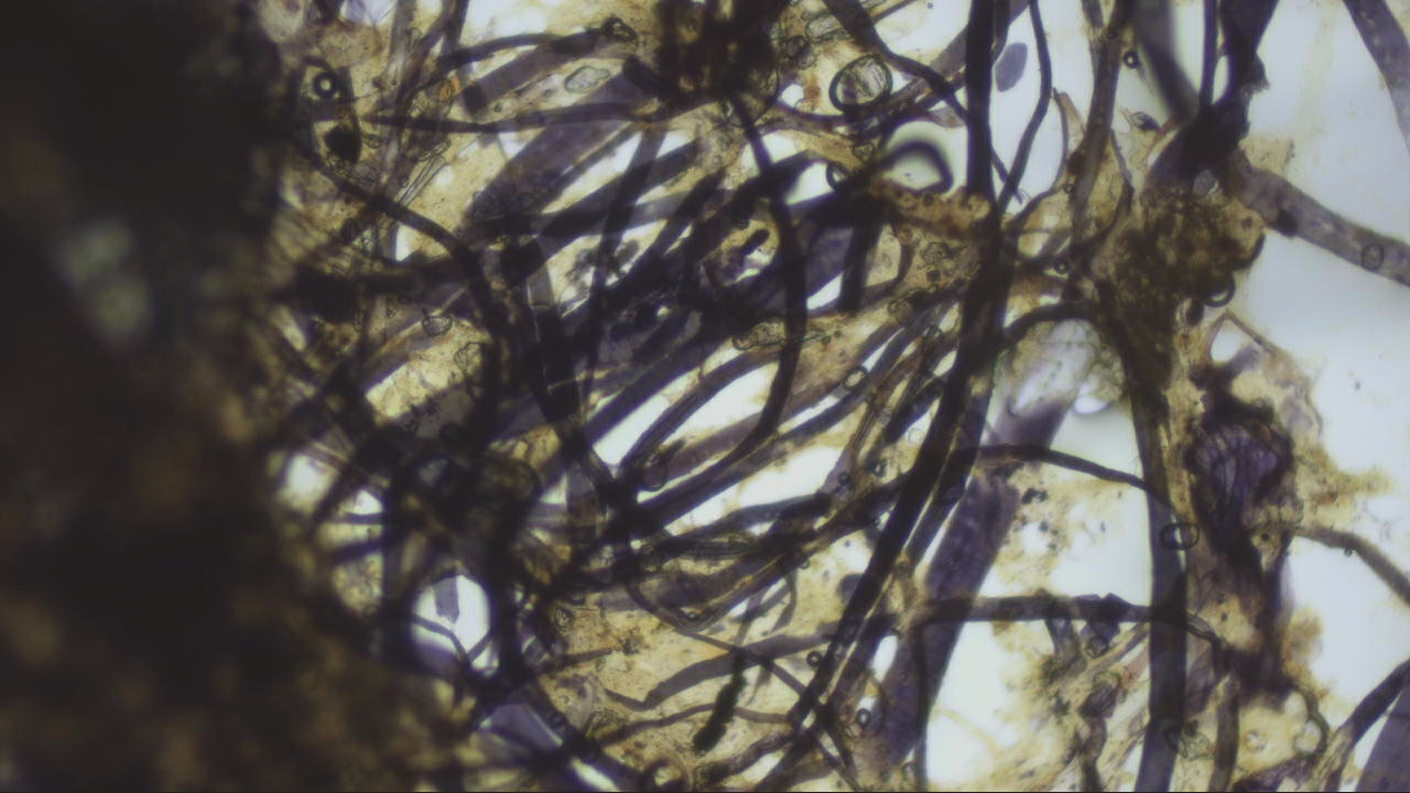 This is a microscopic image of the pulpy material that LOTT is working to identify. It has been prepared using the Herzberg Staining Process.